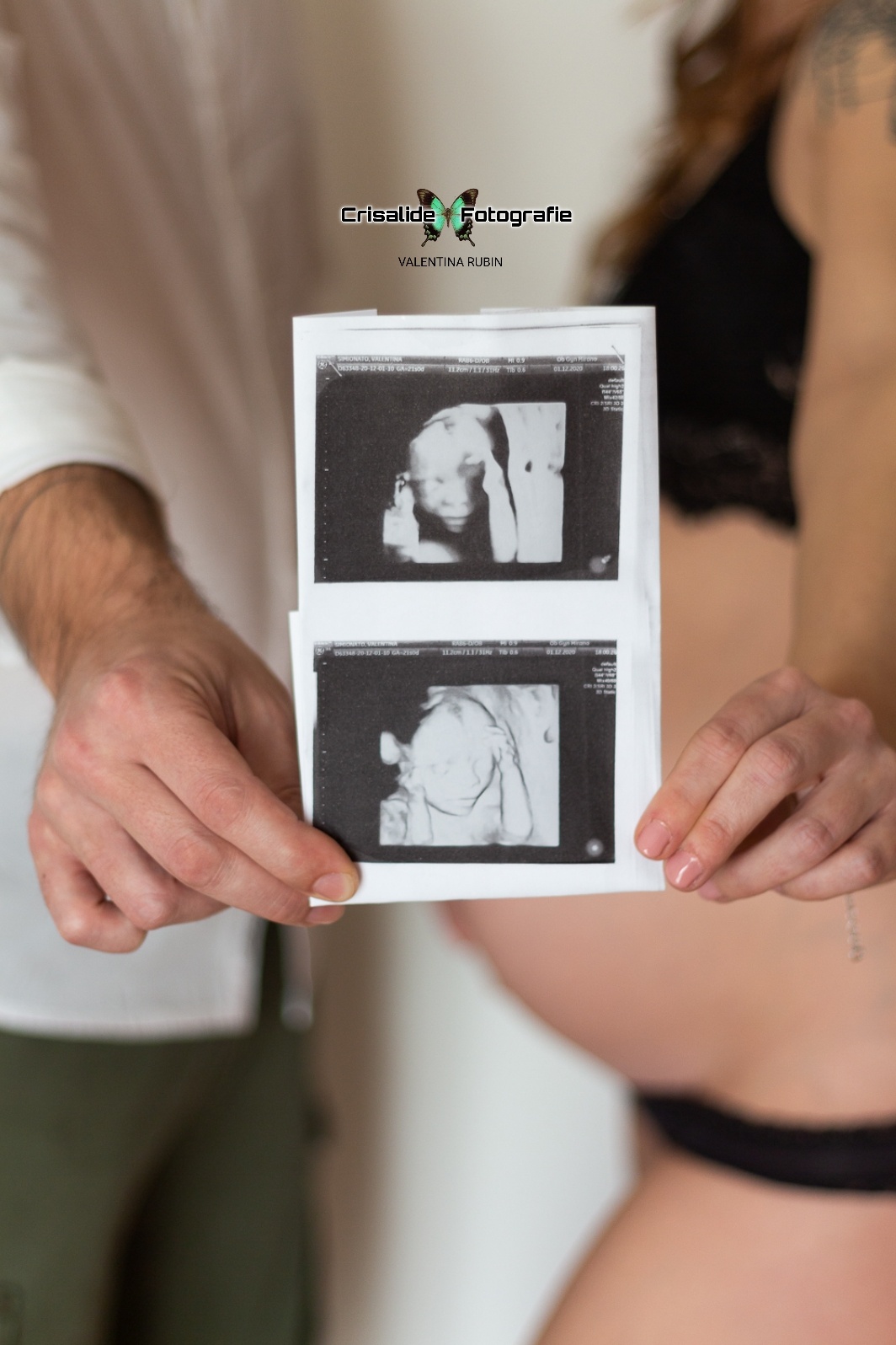 Un ecografia di una bambina, tenuta tra le dita di papà e mamma